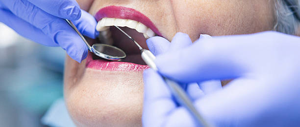 Best Emergency Root Canal Treatment in Montpelier, IN
